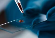 Аналіз крові передбачає ризик розвитку деменції у жінок за роки до появи симптомів