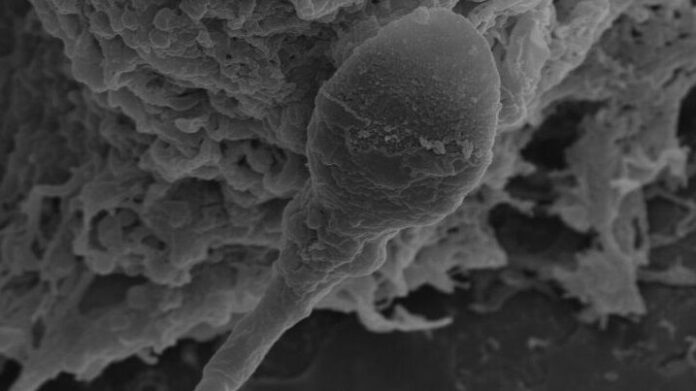 9755a559-7bbd-418f-adfb-b52c4670d822