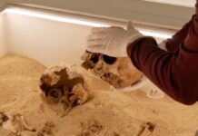 Стародавні Обійми Розкривають Найраніше Відомий Випадок Рідкісного Генетичного Захворювання