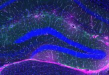 Фізичні Вправи Зміцнюють Захист Мозку, Розкриваючи Ключові Механізми Профілактики Альцгеймера