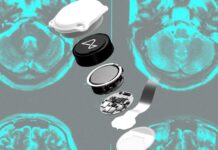 Разворот Neuralink: меняет ли Илон Маск грандиозные амбиции на медицинскую реальность?