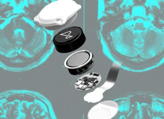 Разворот Neuralink: меняет ли Илон Маск грандиозные амбиции на медицинскую реальность?