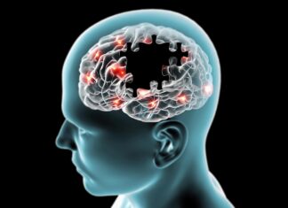 Il grasso invia cattivi segnali al cervello