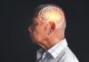 Chodzenie 3000 kroków dziennie spowalnia chorobę Alzheimera: nowe badania wyjaśniają mechanizmy